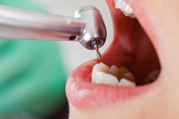 Best Pediatric Emergency Dentist in West Puente Valley, CA